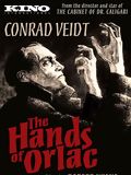 Les Mains D'Orlac