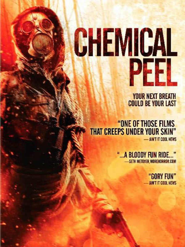 Chemical Peel stream