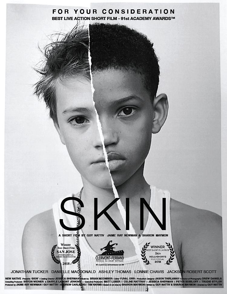 Skin